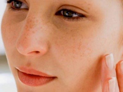 Масло календулы: свойства, применение в косметологии для волос и лица